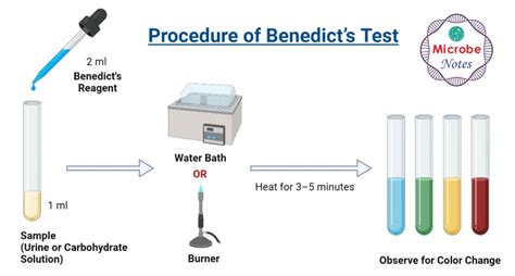 Benedict's Test: Principle, Requirements, Procedure .